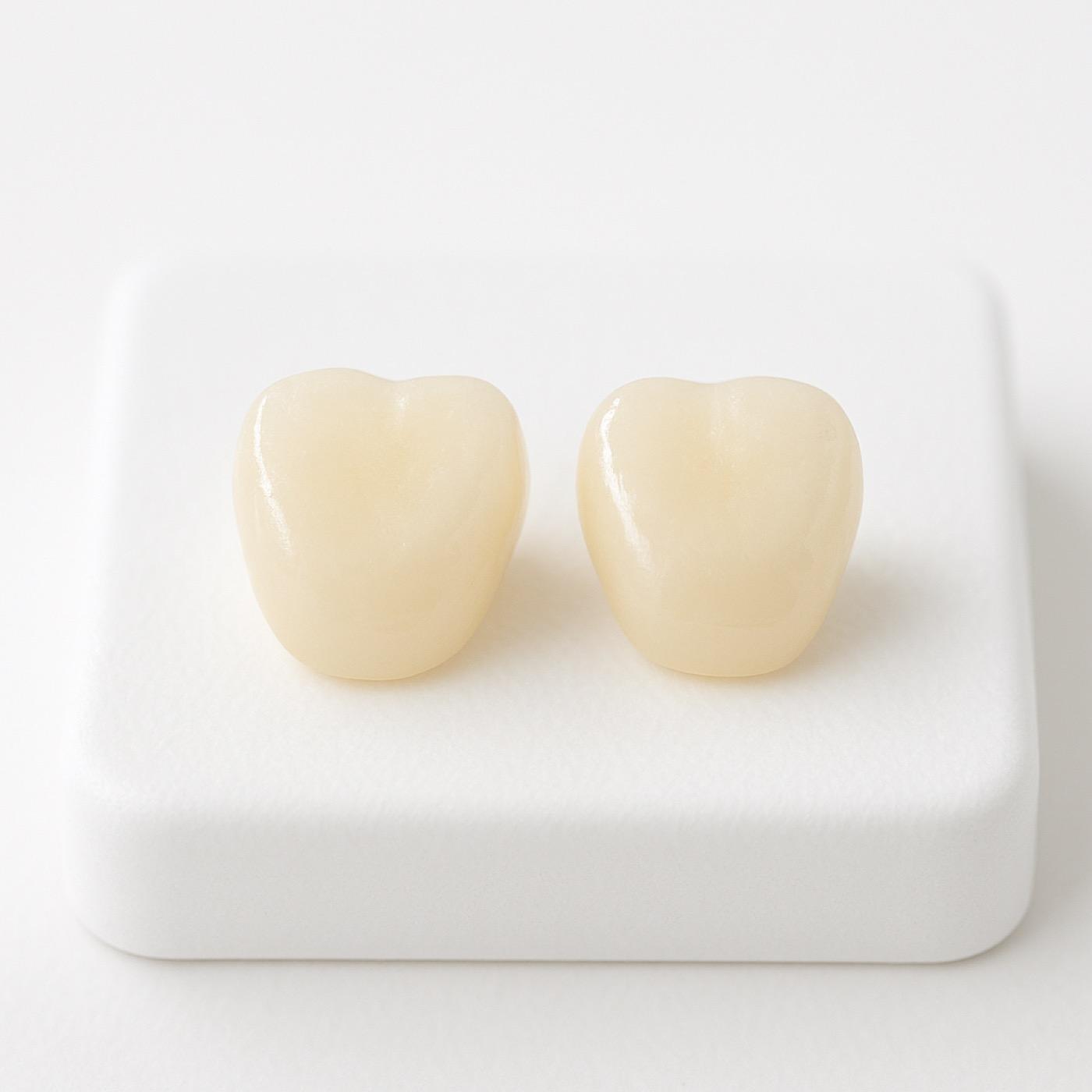White Composite Fillings